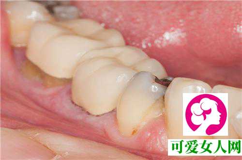 1.牙龈出血和肝脏病变
